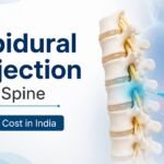 Epidural Injection for Spine Cost in India – 2026
